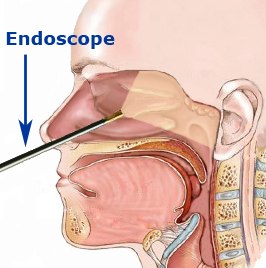 endoscopic